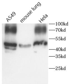 PTGS2 Antibody