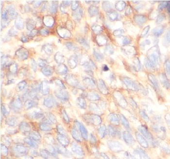 GFPT1 Rabbit Polyclonal Antibody