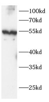 ATP5F1A Rabbit Polyclonal Antibody