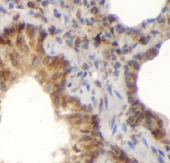 ATP5F1A Rabbit Polyclonal Antibody