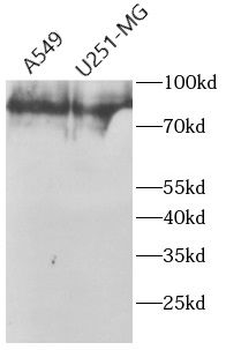 TICAM1 Rabbit Polyclonal Antibody