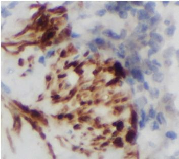 CTCFL Rabbit Polyclonal Antibody