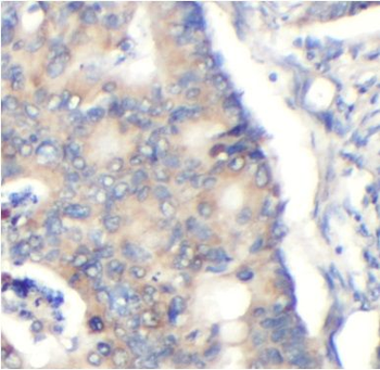 MYOC Rabbit Polyclonal Antibody