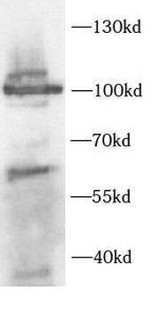 CHM Rabbit Polyclonal Antibody