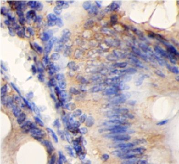 CHM Rabbit Polyclonal Antibody