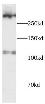 UTRN Rabbit Polyclonal Antibody