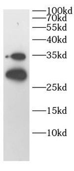 TIGAR Rabbit Polyclonal Antibody