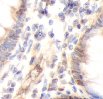 TIGAR Rabbit Polyclonal Antibody