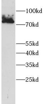 ECD Rabbit Polyclonal Antibody