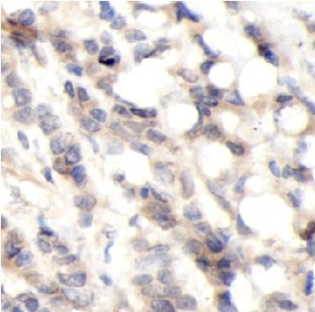 ECD Rabbit Polyclonal Antibody