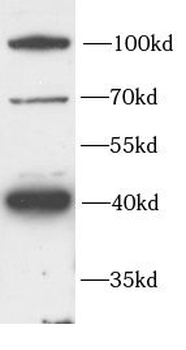 FZD4 Rabbit Polyclonal Antibody