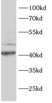 AKT1S1 Rabbit Polyclonal Antibody