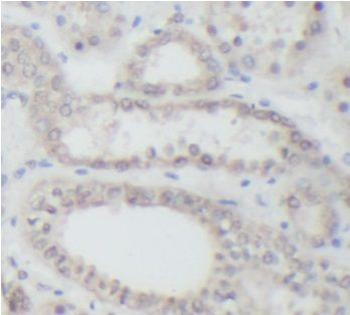 AKT1S1 Rabbit Polyclonal Antibody