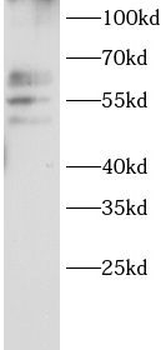 ABCE1 Antibody