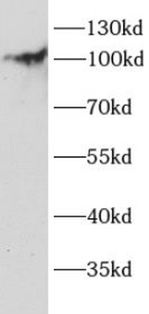 ITCH Rabbit Polyclonal Antibody