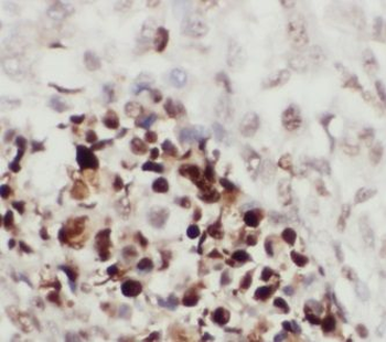 ITCH Rabbit Polyclonal Antibody