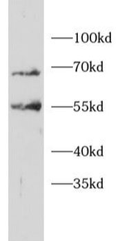ITCH Rabbit Polyclonal Antibody