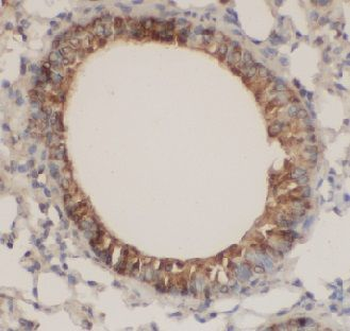 PRKCH Rabbit Polyclonal Antibody