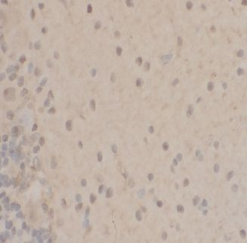 PPP1CA Rabbit Polyclonal Antibody