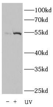 Phospho p53 (Ser15) Rabbit Polyclonal Antibody