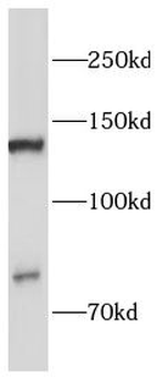 CDH5 Rabbit Polyclonal Antibody