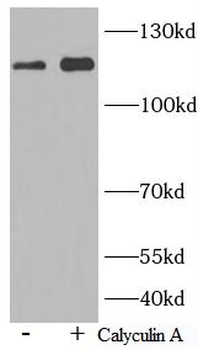 Phospho NFKB1 (S337) Rabbit Polyclonal Antibody