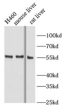 SOAT1 Antibody