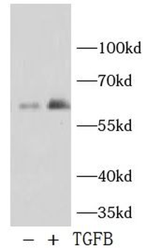 Phospho Smad2 (S465/S467) Rabbit Polyclonal Antibody