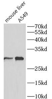 SLC31A1 Rabbit Polyclonal Antibody