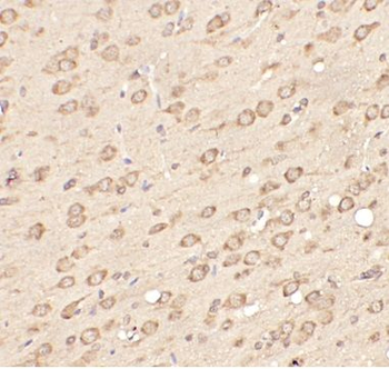 OPRM1 Rabbit Polyclonal Antibody