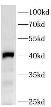 RFP Mouse Monoclonal Antibody