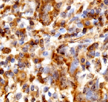 WFDC12 Antibody