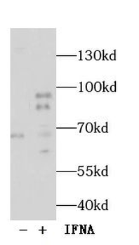 Phospho-STAT1 (Tyr701) Antibody