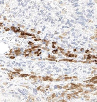 ABCB5 Rabbit Polyclonal Antibody