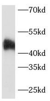 GNA15 Rabbit Polyclonal Antibody
