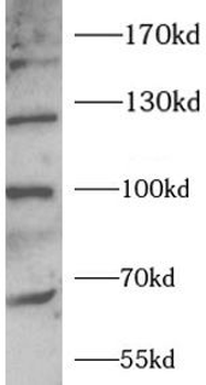LDLR Antibody
