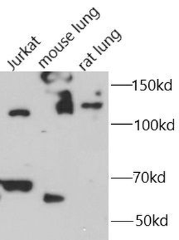 IL16 Rabbit Polyclonal Antibody