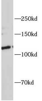 NOTCH2 Rabbit Polyclonal Antibody