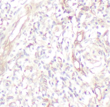 NOTCH2 Rabbit Polyclonal Antibody