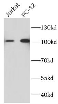 CIP2A Mouse Monoclonal Antibody
