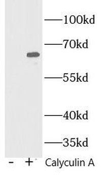 Phospho NF kB p65  (S536) Rabbit Polyclonal Antibody