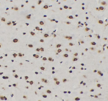 Phospho NF kB p65  (S536) Rabbit Polyclonal Antibody