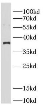 ANXA1 Mouse Monoclonal Antibody