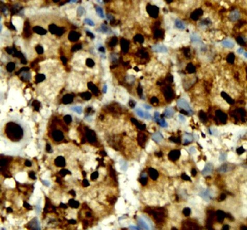 ANXA1 Mouse Monoclonal Antibody