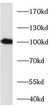 CD276 Mouse Monoclonal Antibody