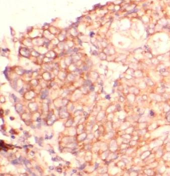 CD276 Mouse Monoclonal Antibody