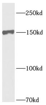 PDGFRA Antibody