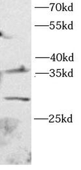 ARG1 Rabbit Polyclonal Antibody