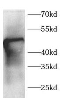 TNFRSF10A Antibody