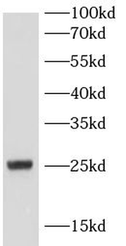 MT ATP6 Rabbit Polyclonal Antibody